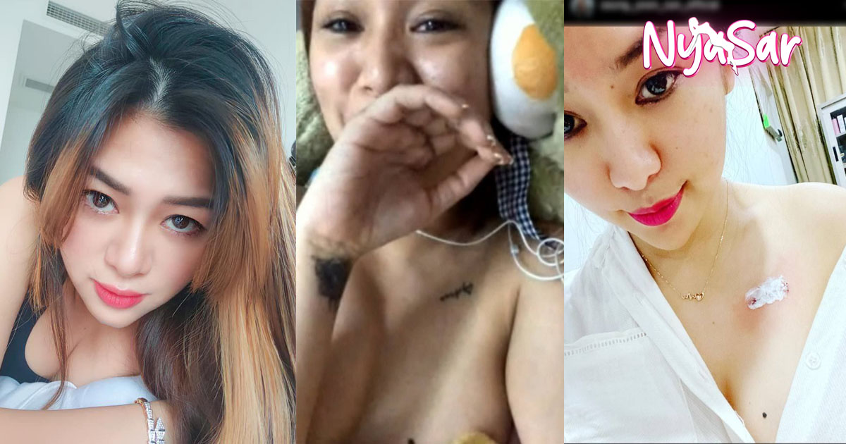 ဘဲကို ရှယ်နှိုက်ပြတာ ပေါက်ကြားသွားတဲ့ ဆောင်းယွန်းစံ